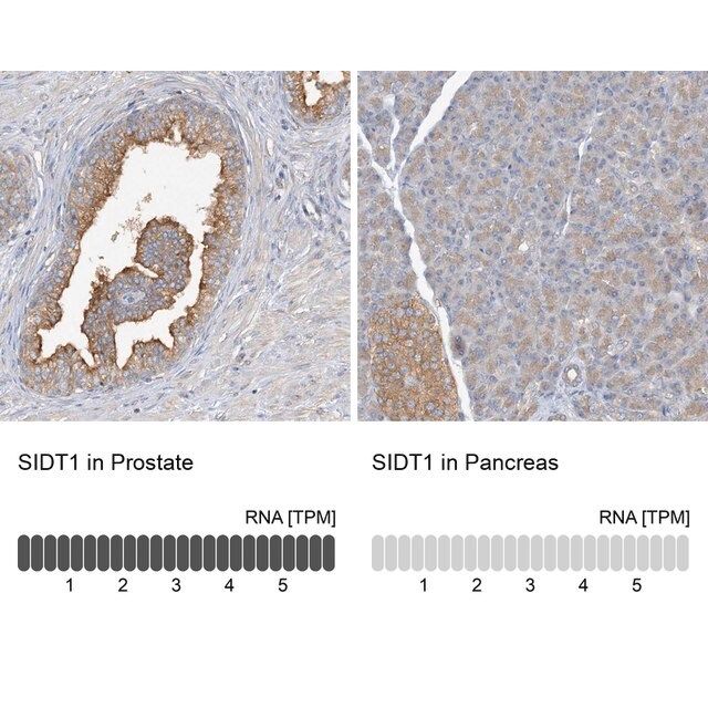 Anti-SIDT1 antibody produced in rabbit