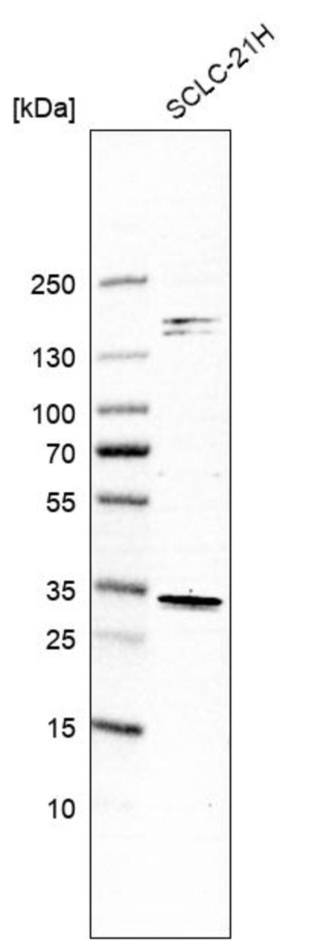 Anti-SIRT5 antibody produced in rabbit