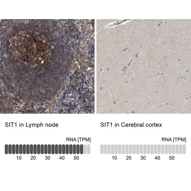 Anti-SIT1 antibody produced in rabbit