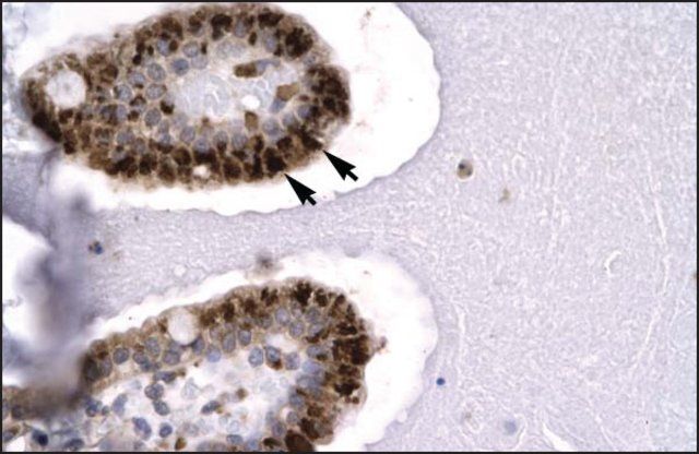 Anti-SIRT5 antibody produced in rabbit