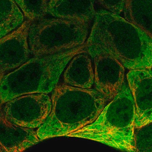 Anti-SCNN1G antibody produced in rabbit