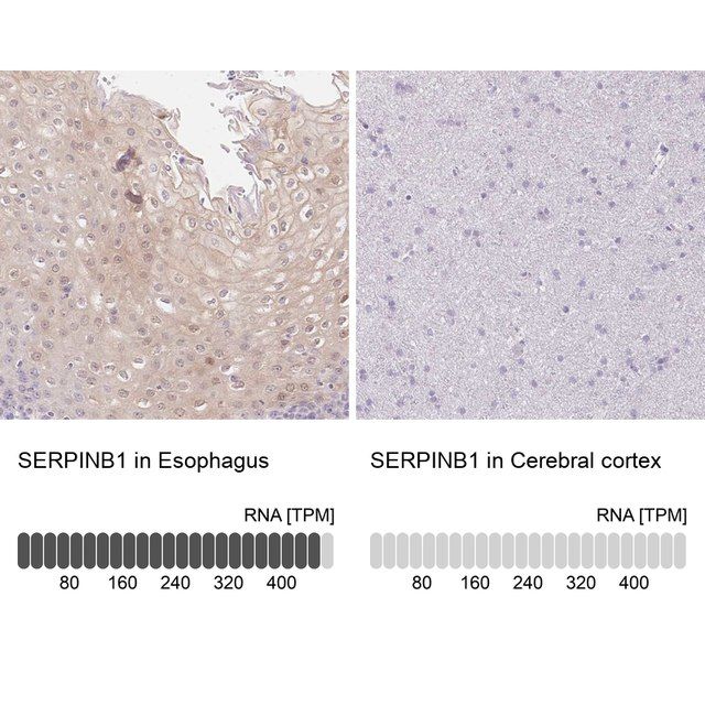 Anti-SERPINB1 antibody produced in rabbit