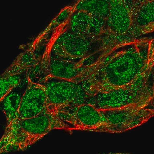 Anti-SERPINA10 antibody produced in rabbit