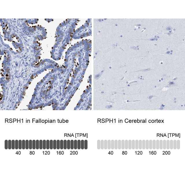 Anti-RSPH1 antibody produced in rabbit