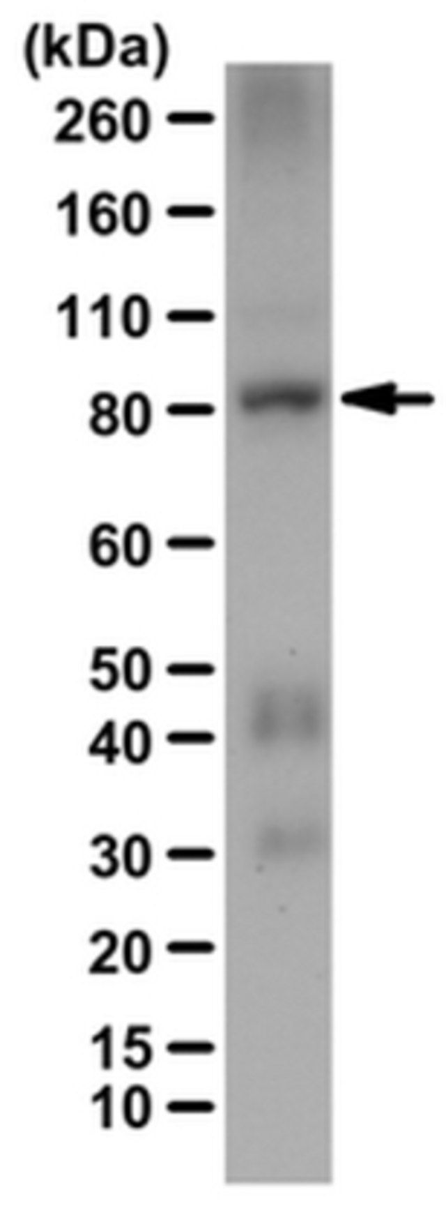 Anti-RSK4 Antibody