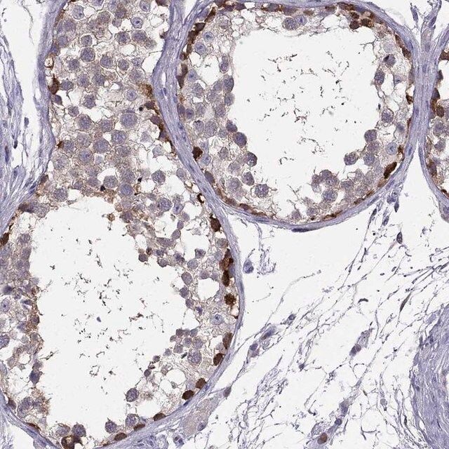 Anti-RSPH14 antibody produced in rabbit