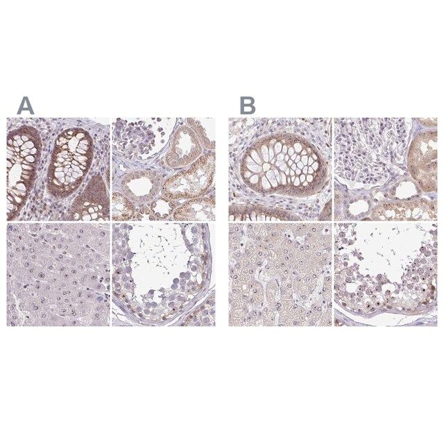 Anti-RSL24D1 antibody produced in rabbit