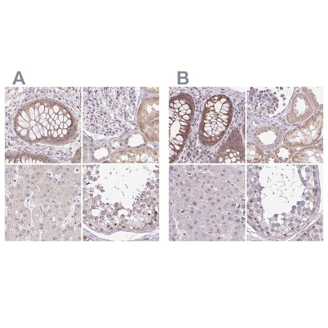 Anti-RSL24D1 antibody produced in rabbit