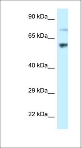 Anti-RSL1D1 antibody produced in rabbit