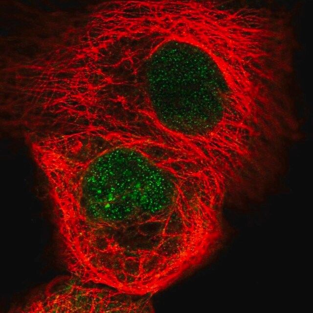 Anti-RSG1 antibody produced in rabbit