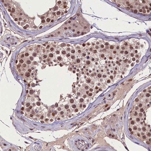 Anti-RNMT antibody produced in rabbit