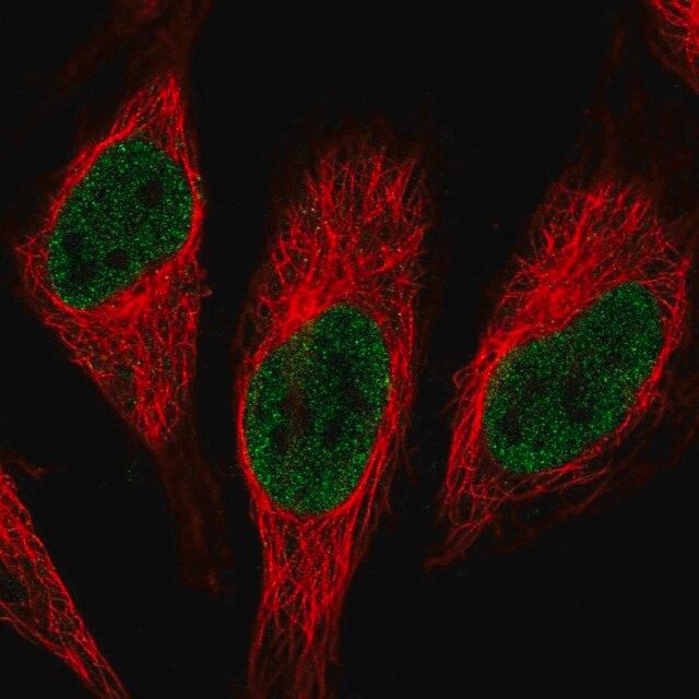 Anti-RNPC3 antibody produced in rabbit