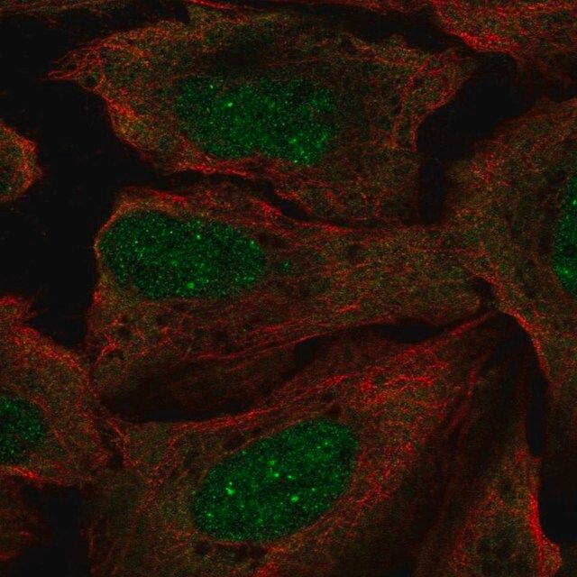 Anti-RP2 antibody produced in rabbit