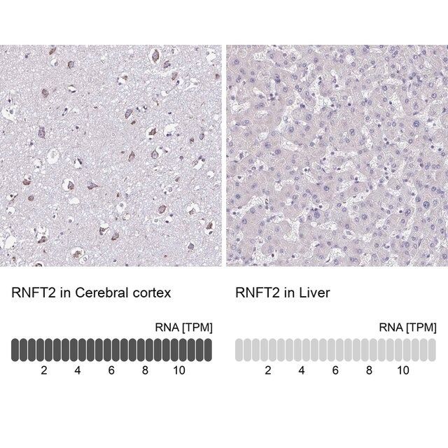 Anti-RNFT2 antibody produced in rabbit