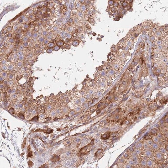 Anti-RNF19B antibody produced in rabbit