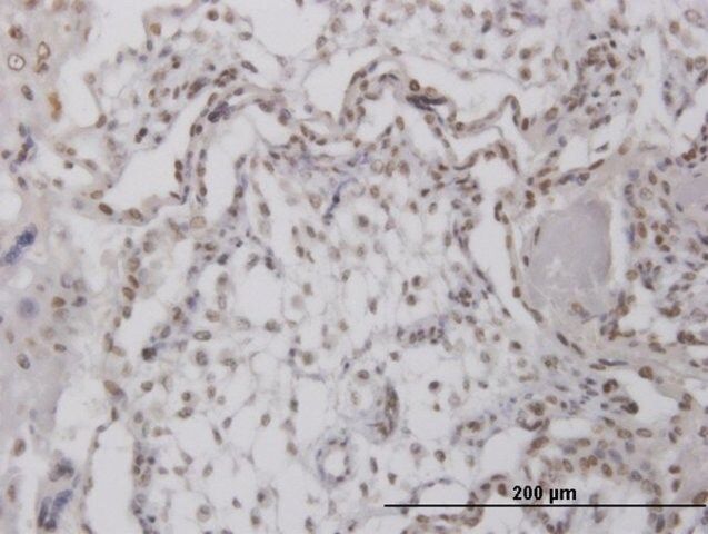 Anti-RPA4 antibody produced in mouse