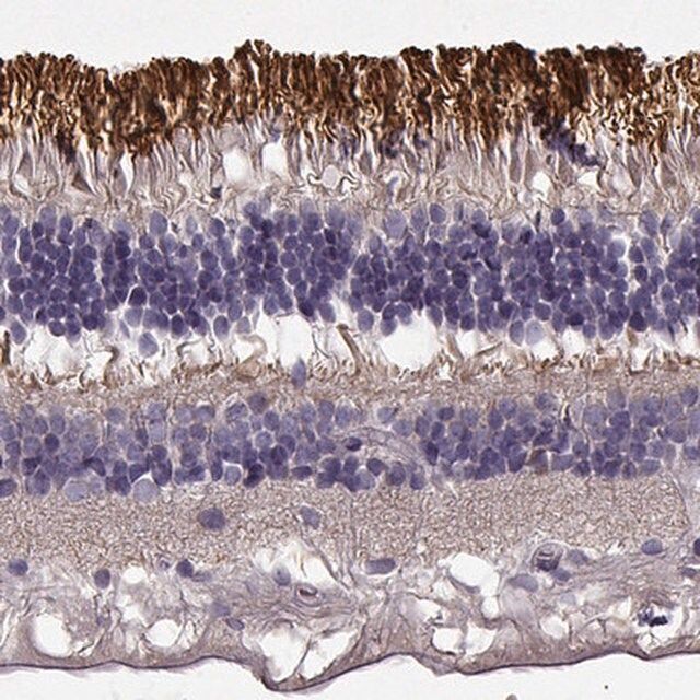 Anti-ROM1 antibody produced in rabbit