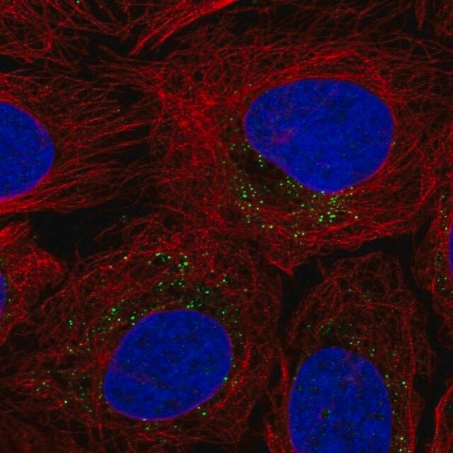 Anti-ROS1 antibody produced in rabbit