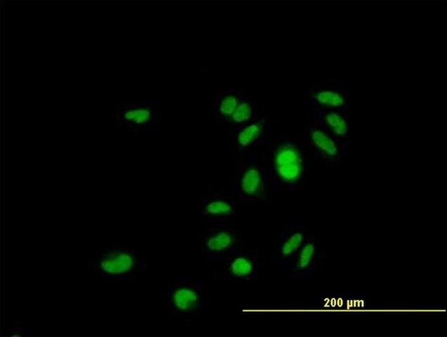 Anti-RP4-691N24.2 antibody produced in mouse