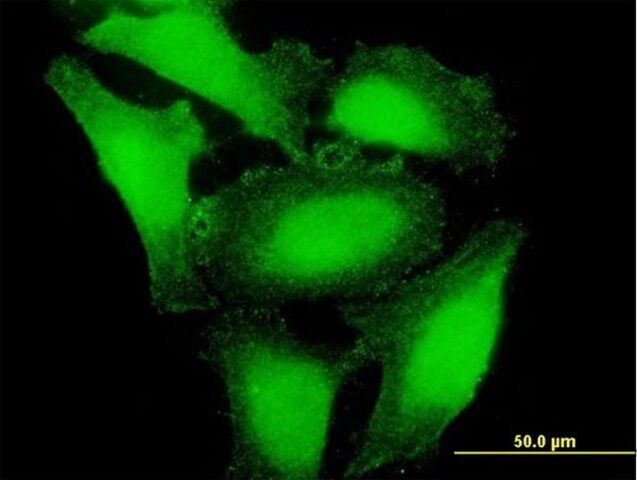 Anti-RP4-742C19.3 antibody produced in mouse