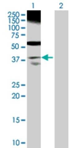 Anti-RP2 antibody produced in rabbit