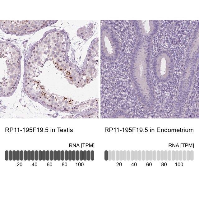 Anti-RP11-195F19.5 antibody produced in rabbit