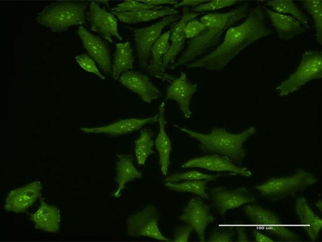 Anti-RP5-1077B9.4 antibody produced in mouse