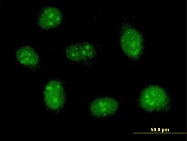 Anti-RP13-383K5.1 antibody produced in mouse