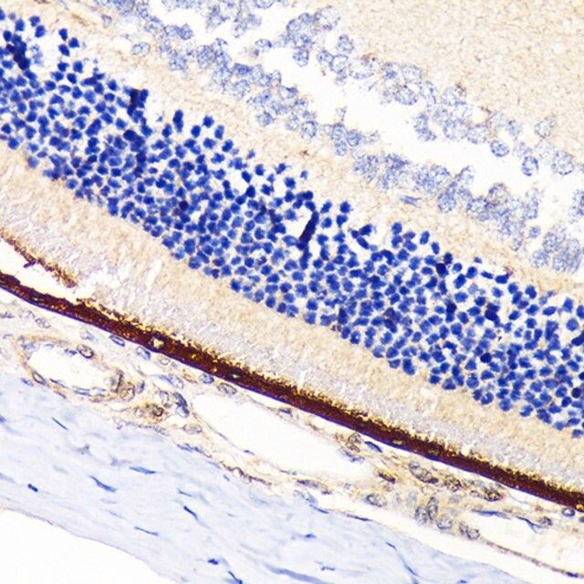 Anti-RPA70 antibody produced in rabbit