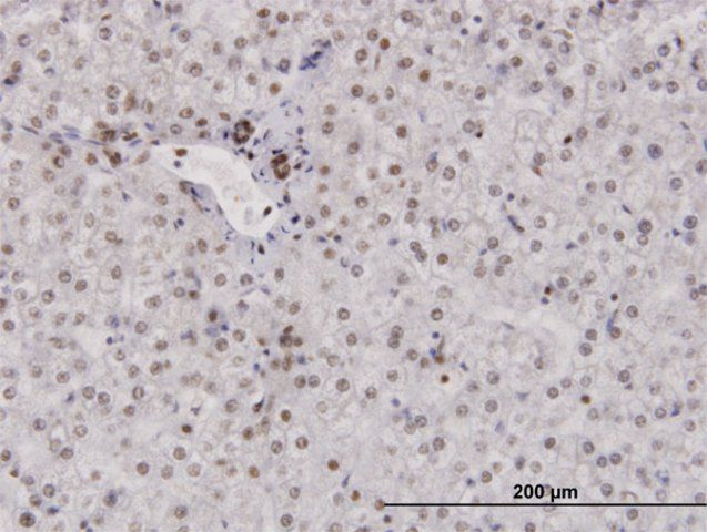 Anti-RPA2 antibody produced in mouse