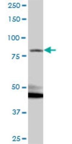 Anti-RP1-21O18.1 antibody produced in mouse