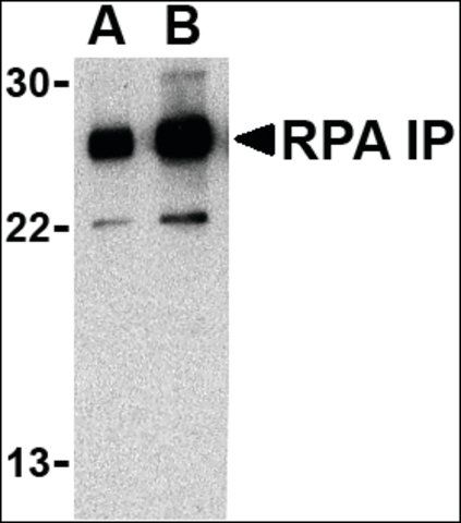 Anti-RPA Interacting Protein (ab2) antibody produced in rabbit