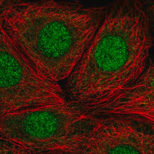 Anti-RP9 antibody produced in rabbit