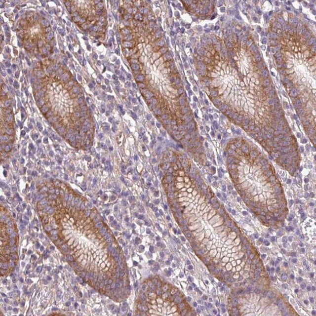 Anti-RP11-849H4.2 antibody produced in rabbit