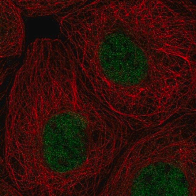 Anti-RPA1 antibody produced in rabbit