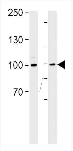 ANTI-RSK2 (RPS6KA3)(N-TERMINAL) antibody produced in rabbit