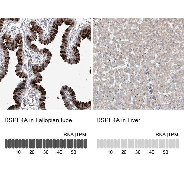 Anti-RSPH4A antibody produced in rabbit