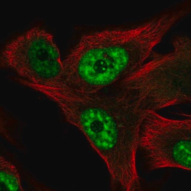 Anti-RCAN3 antibody produced in rabbit