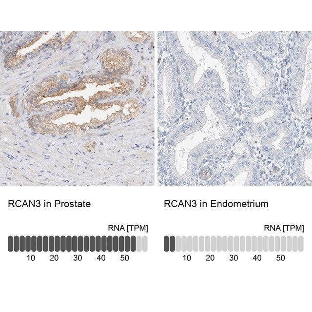 Anti-RCAN3 antibody produced in rabbit