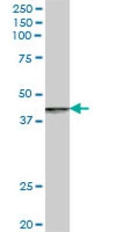 Anti-RABEP2 antibody produced in mouse