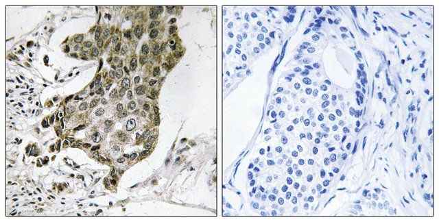 Anti-RABEP1 antibody produced in rabbit