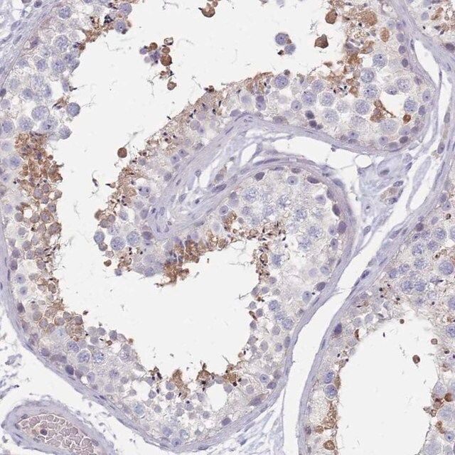 Anti-RAB11FIP4 antibody produced in rabbit