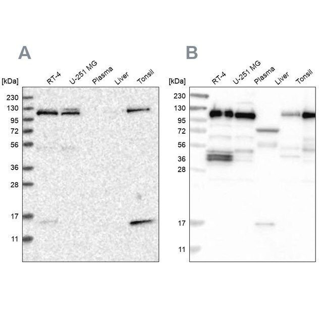 Anti-RABEP1 antibody produced in rabbit