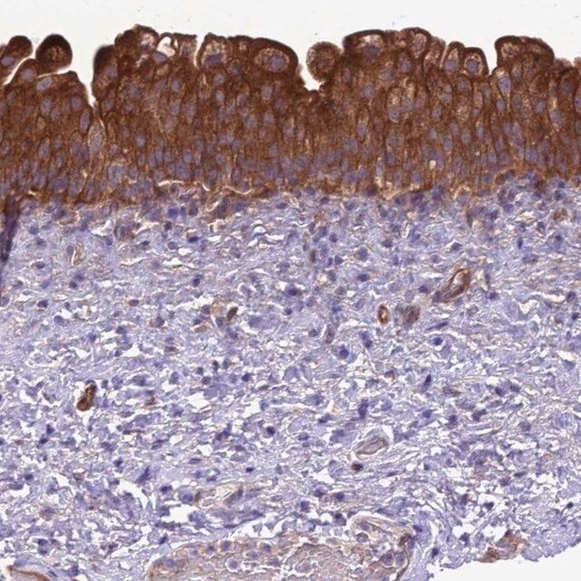 Anti-RABEP2 antibody produced in rabbit