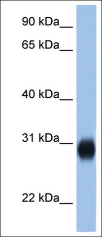 Anti-RAB3D antibody produced in rabbit