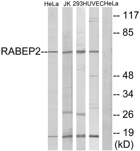 Anti-RABEP2 antibody produced in rabbit