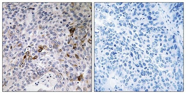 Anti-RAB11FIP3 antibody produced in rabbit