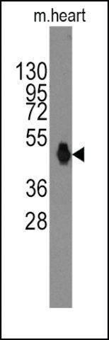 Anti-Rat TRPV3 (C-term) antibody produced in rabbit