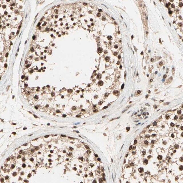 Anti-RBM25 antibody produced in rabbit