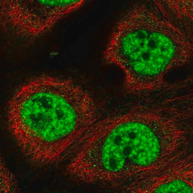 Anti-RBM10 antibody produced in rabbit